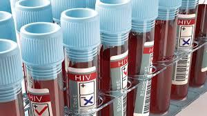 O vírus HIV/Aids as grandes descobertas mostram que cura e a vacina podem estar muito próxima